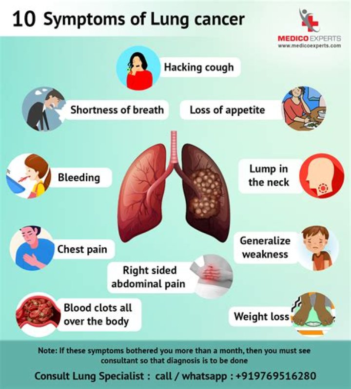 10 Signs & Symptoms of an Unusual Blood Clot You Should Know Top 10