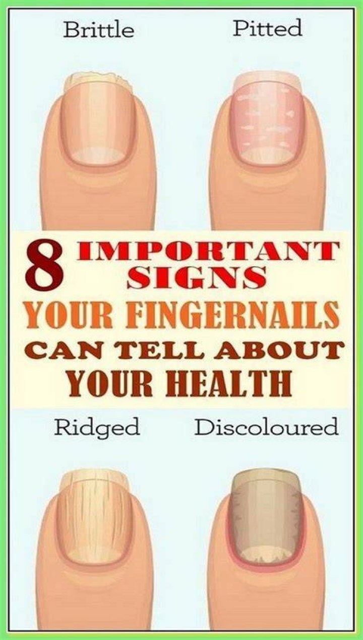 15 Health WARNINGS Your Fingernails May Be Sending