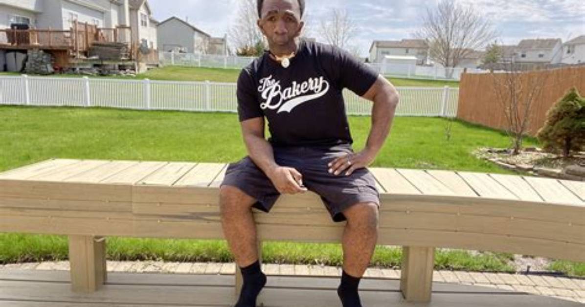 41-Year-Old Man Born Without Jaw Finds Love, Marries Cute Lady, Their Stunning Story Goes Viral