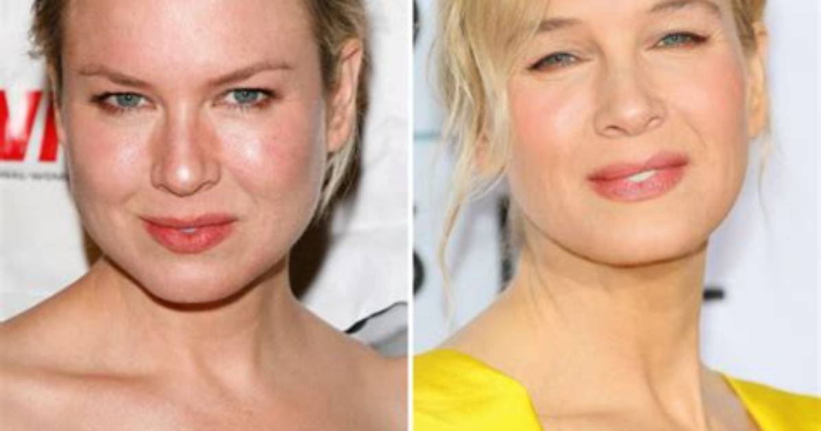 A Dive into Renee Zellweger’s Plastic Surgery Rumors and Her Response to Them over the Year's