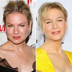 A Dive into Renee Zellweger’s Plastic Surgery Rumors and Her Response to Them over the Year's