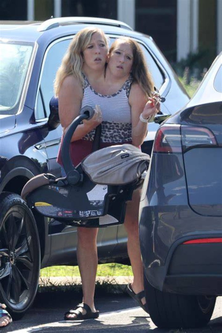 Abby and brittany hensel conjoined twins quietnelo