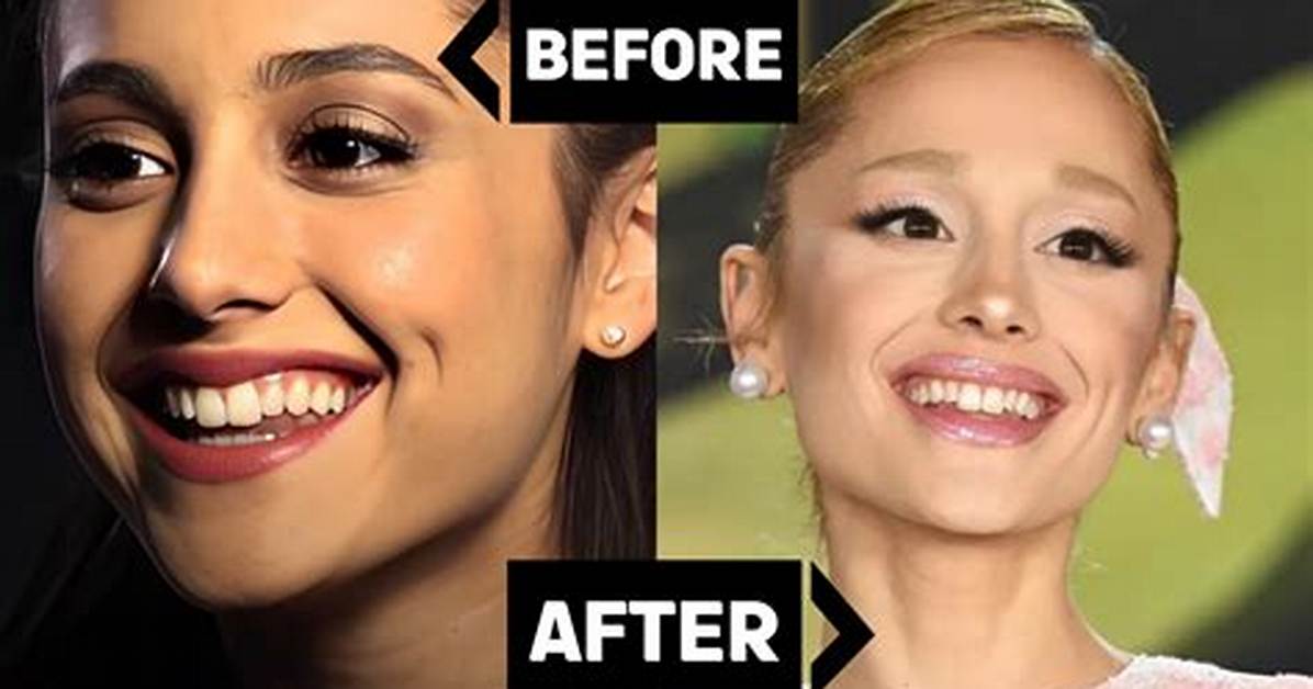 Ariana Grande’s Bunny Teeth Live Rent Free in Her Fans’ Heads