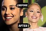 Ariana Grande’s Bunny Teeth Live Rent Free in Her Fans’ Heads
