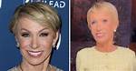 Barbara Corcoran | No Makeup | Plastic Surgery