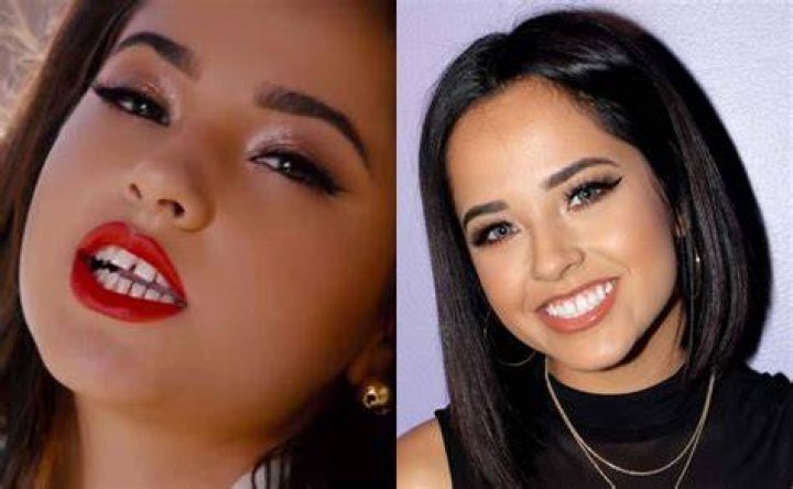 Becky G El antes y el despu&eacute;s de su cirug&iacute;a est&eacute;tica