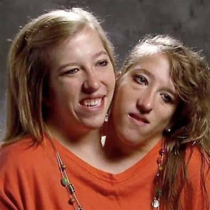 Brittany & Abby Conjoined Twins Major Update! Married & What Else