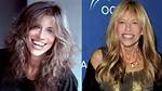 Carly Simon | Wrong with Face? Plastic Surgery Before and After