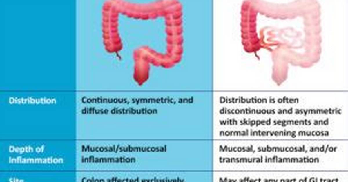Chantelle Leonardo Illness | Ibd Uc Diagnosis and Surgery