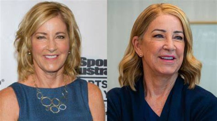 Chris Evert&rsquo;s Plastic Surgery Her New Look Examined!