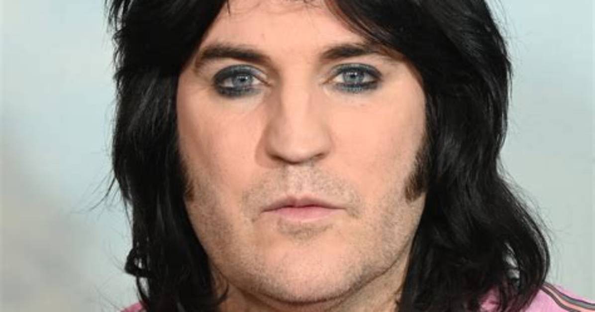 Controversy over Noel Fielding | What He Said | Accusations and Homophobic Jokes