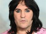 Controversy over Noel Fielding | What He Said | Accusations and Homophobic Jokes