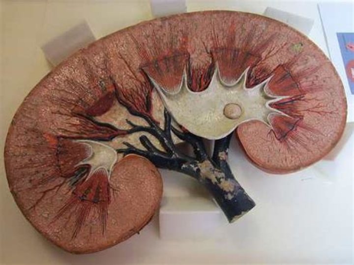 Coping With Nephrectomy My Silent Cancer and Kidney Removal HubPages