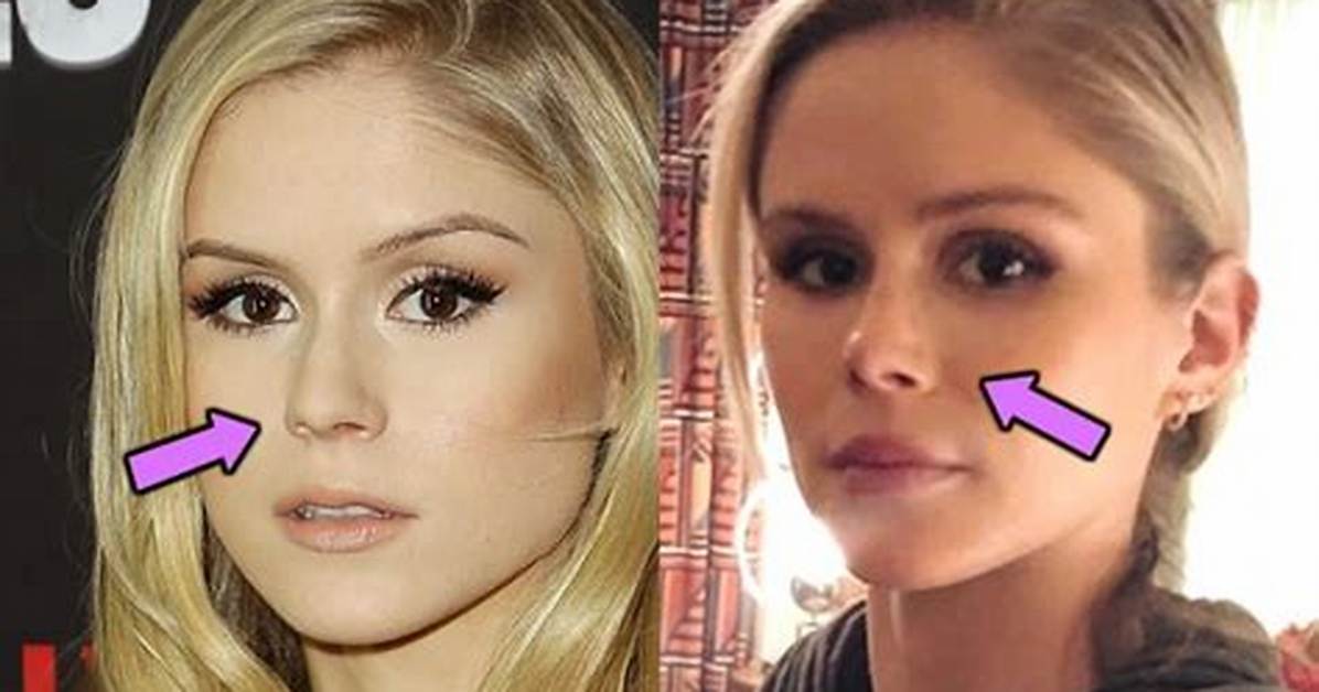 Did Erin Moriarty Get a Nose and Lips Done? Plastic Surgery