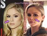 Did Erin Moriarty Get a Nose and Lips Done? Plastic Surgery