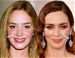Emily Blunt Botox and Nose Surgery: Did She Underwent Surgery? | How Does Emily Look Like After Surgery?