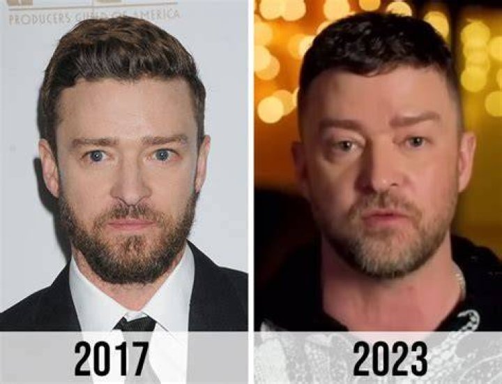 Fans Think Justin Timberlake Had &lsquo;Bad Plastic Surgery&rsquo; After His Latest