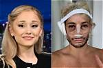Frankie Grande Plastic Surgery Before and After Look