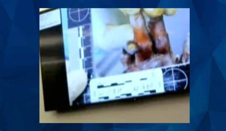 Gannon Stauch Autopsy Photo Reddit Leaked