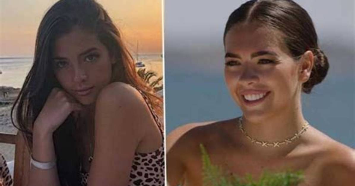 Gemma Owen Plastic Surgery Trending: Before and After