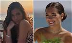 Gemma Owen Plastic Surgery Trending: Before and After