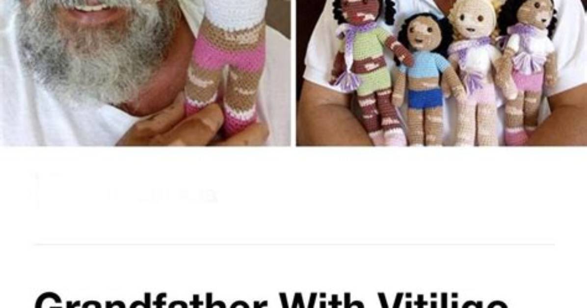 Grandfather with Vitiligo Crochets Dolls for Kids Living with the Same Condition: “They Feel Represented”