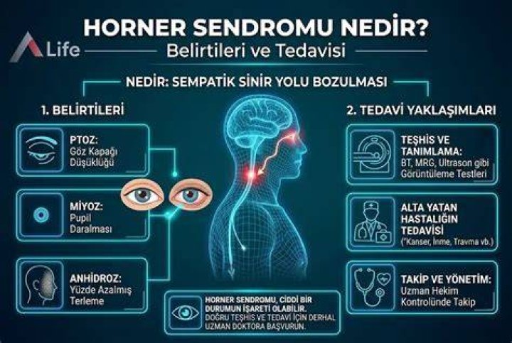 Habba Sendromu, Belirtileri Nedenleri ve Tedavisi > Bilgiustam