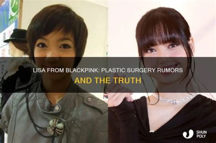 Has Lisa Had Plastic Operation? See Her Transformation In Photos