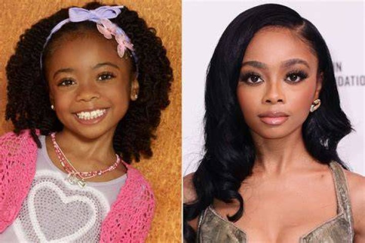 Has Skai Jackson Had Plastic Surgery? Body Measurements and More