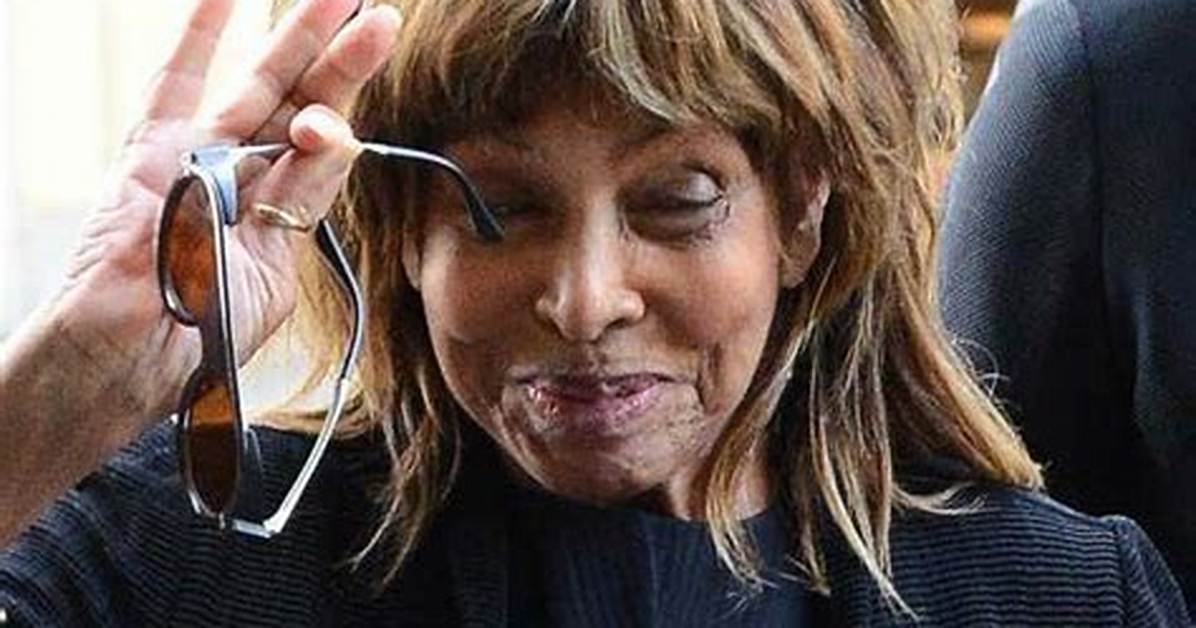 How Did Tina Turner Look Without Wig? Hair Loss and Cancer Update