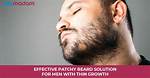 How to Fix a Patchy Beard: 5 Ways to Get Facial Hair You Want