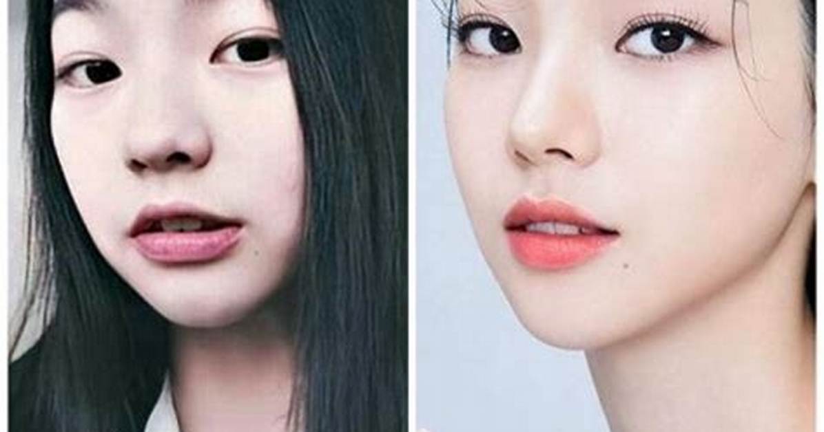 Huening Kai Nose Job: Plastic Surgery Before and After Photos