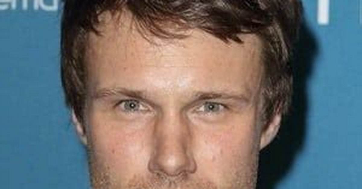 Hugh Skinner – British Actor | Net Worth, Age, Bio, Wiki, Career, Family, Nationality, Ethnicity, Partner, Photos and Facts