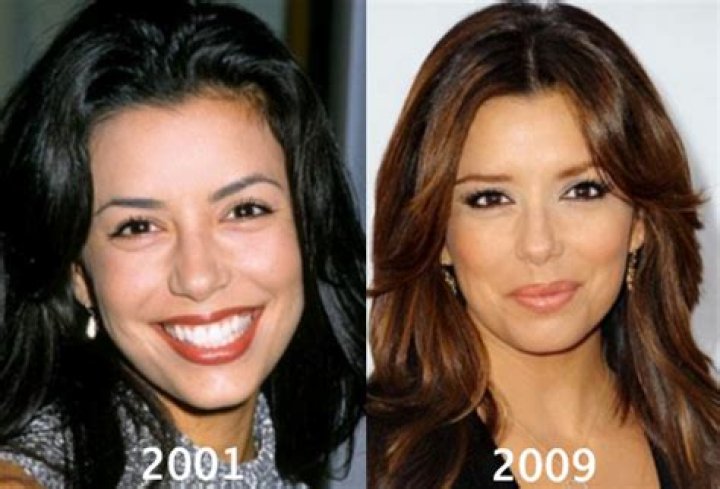 Is Plastic Surgery Eva Longoria&rsquo;s Secret to Evergreen Youthful Beauty?