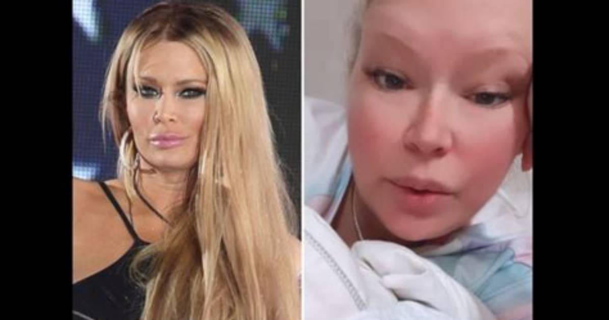 Jenna Jameson Illness 2023 Guillain Barr%C3%A9 Syndrome 150. Jpg