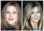 Jennifer Aniston Nose Job | Botox and Lip Filler Before and After Photos