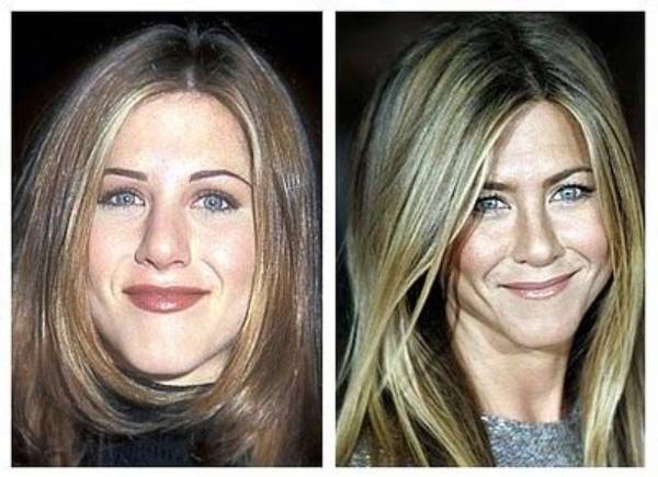 Jennifer Aniston Nose Job | Botox and Lip Filler Before and After Photos