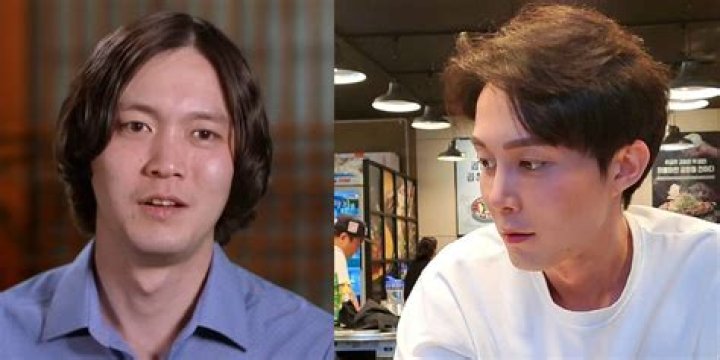 Jihoon Lee's Plastic Surgery Transformation In Photos Armessa Movie