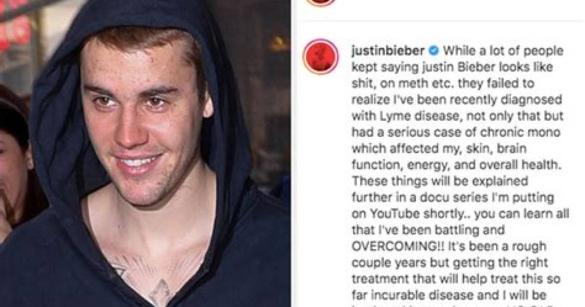 Justin Bieber Diagnosed with Lyme Disease — Here's a Run Down of What That Means for Beliebers