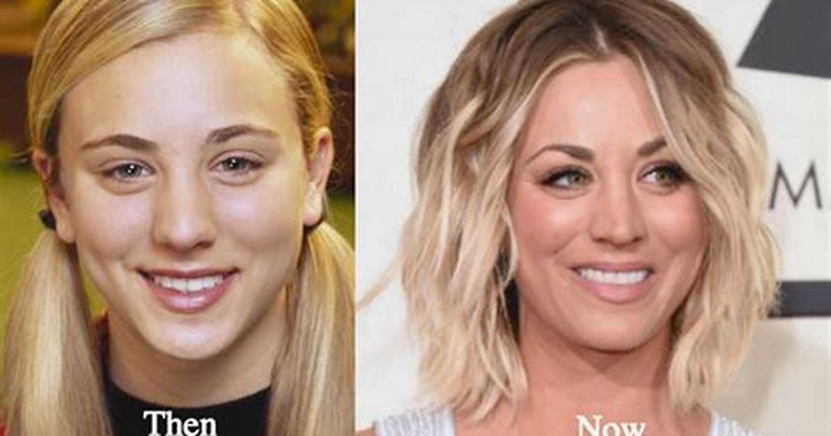 Kaley Cuoco Botox: Before and After Photos