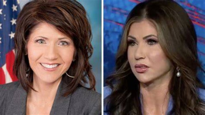 Kristi Noem Before Plastic Surgery Kristi Noem Photos Of The South