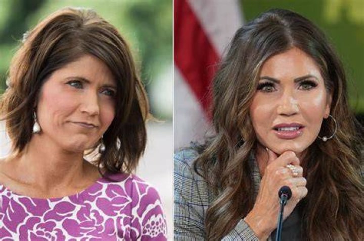 Kristi Noem Plastic Surgery Revealing the Beauty Secrets Behind Her