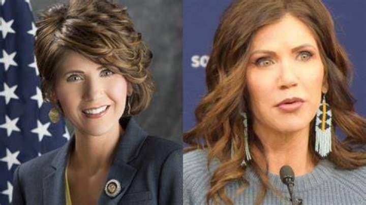 Kristi Noem&rsquo;s Plastic Surgery Couldn&rsquo;t Be More Obvious to Viewers