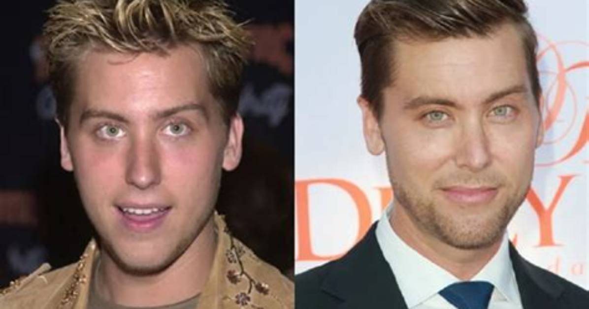 Lance Bass Plastic Surgery: Before and After Photos