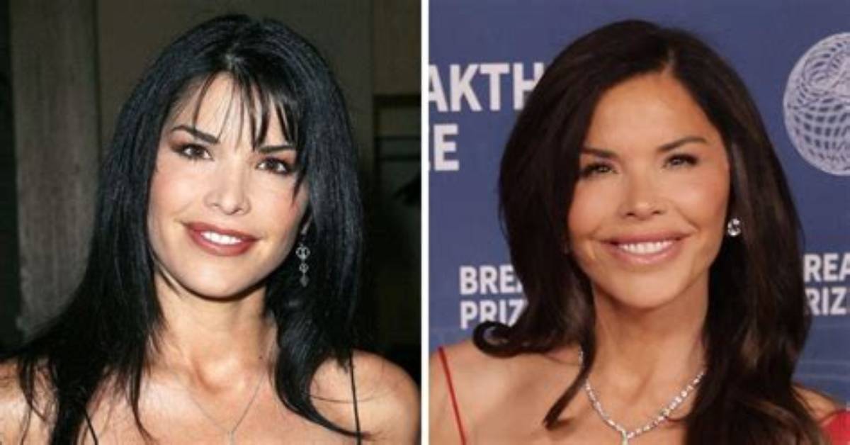 Lauren Sanchez Before Surgery – Did She Underwent Plastic Surgery?