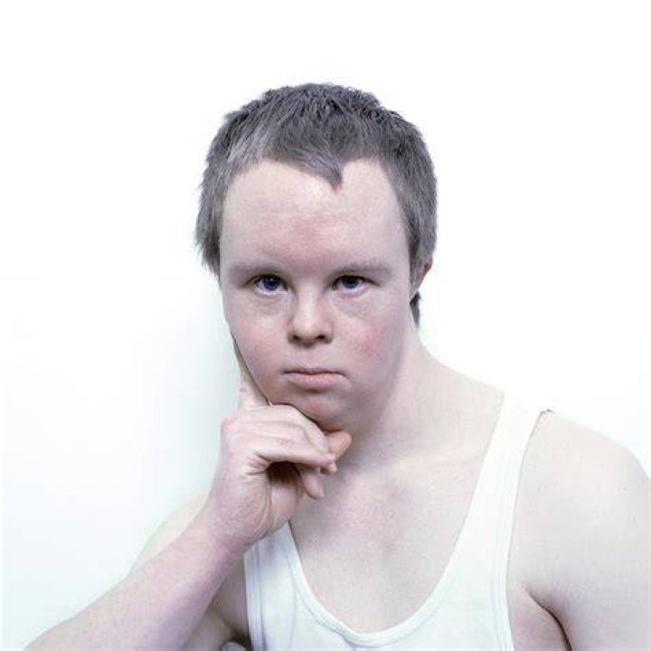 Man with Down&rsquo;s syndrome &lsquo;died after hospital left him without food for