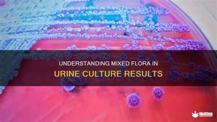 Mixed flora in Urine Sample YouTube