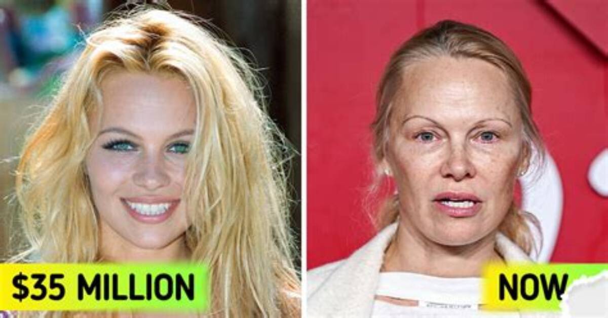 Pamela Anderson Net Worth: How Much Is Anderson Worth?