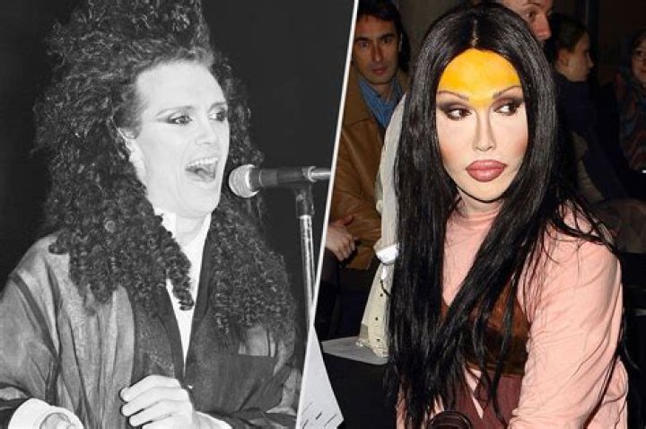 Pete Burns Dead His Changing Appearance Through the Years