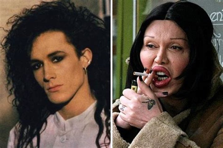 Pete Burns, Dead or Alive singer, dies at 57
